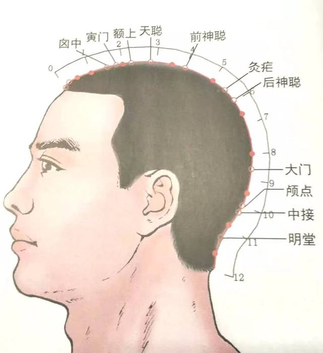 经外奇穴|颅点