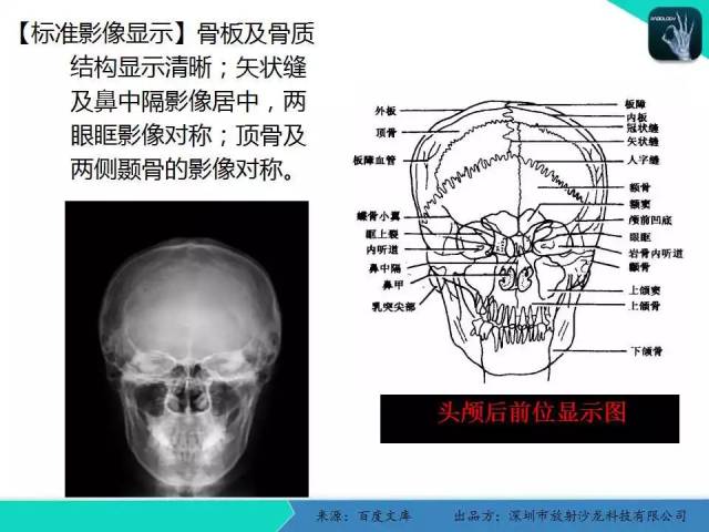 人体各部位x线摄影技术