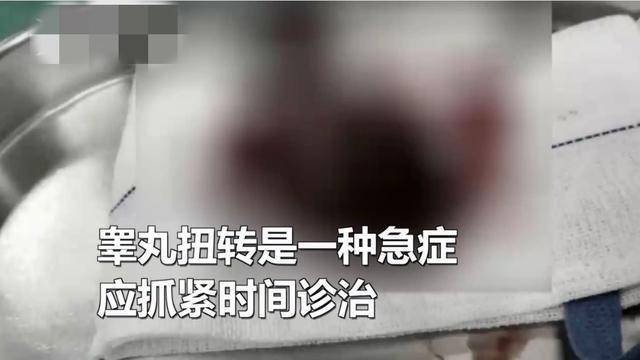 勿以"蛋疼"为小事,少年睾丸扭转未及时医治遭切除!