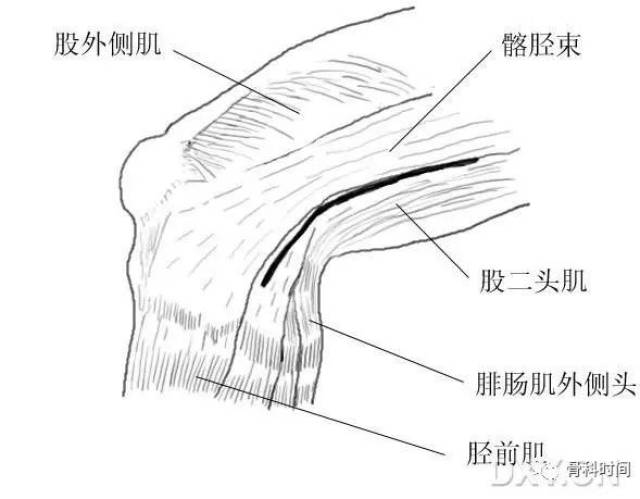 这份膝关节手绘图谱,你一定不能错过!