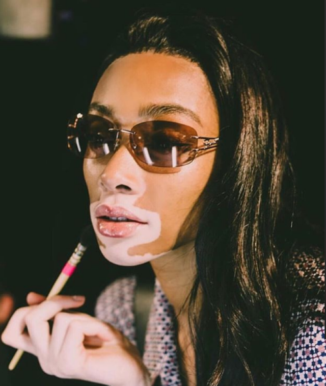 白癜风超模是谁个人资料照片 Winnie Harlow为什么被骂人品差?