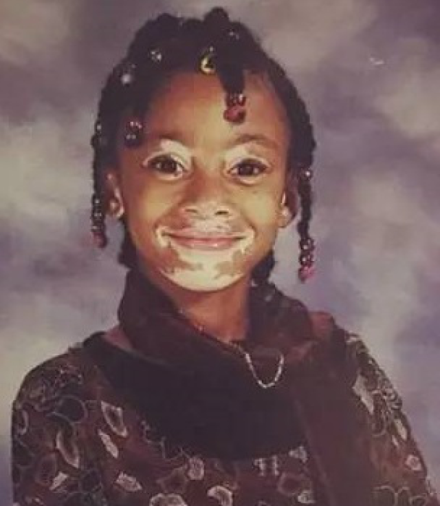 白癜风超模是谁个人资料照片 Winnie Harlow为什么被骂人品差?