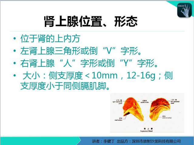 【11/7日直播预告】李健丁《肾上腺病变的msct表现(一》_手机搜狐网