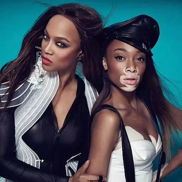 白癜风超模是谁个人资料照片 Winnie Harlow为什么被骂人品差?