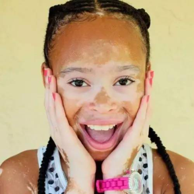 白癜风超模是谁个人资料照片 Winnie Harlow为什么被骂人品差?