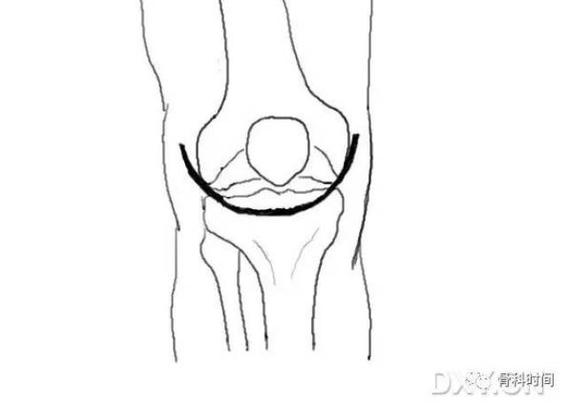 这份膝关节手绘图谱,你一定不能错过!