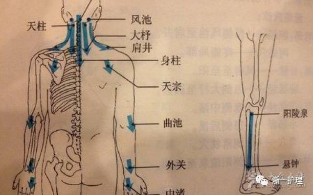 1.孕妇的腹部,腰骶部,妇女的乳头禁刮;22.