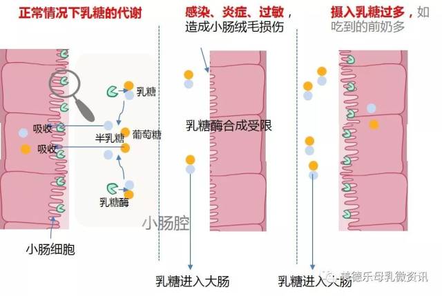 想要了解乳糖不耐受会不会影响母乳喂养,我们先看看什么是乳糖不耐受