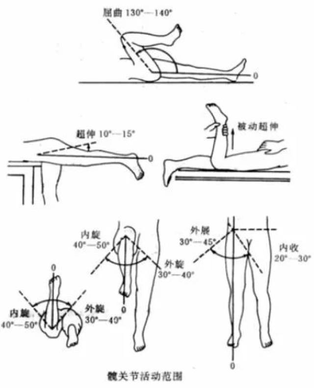 髋关节查体怎么做?一篇全搞定!