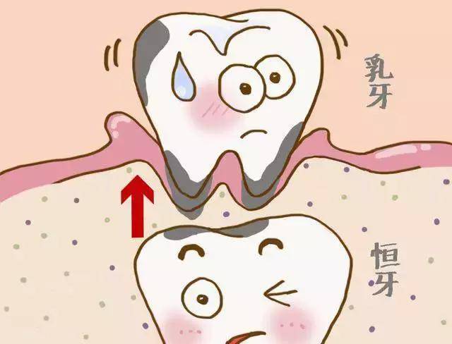 刷牙+不吃糖=不蛀牙儿童口腔健康五大误区,您中招了么