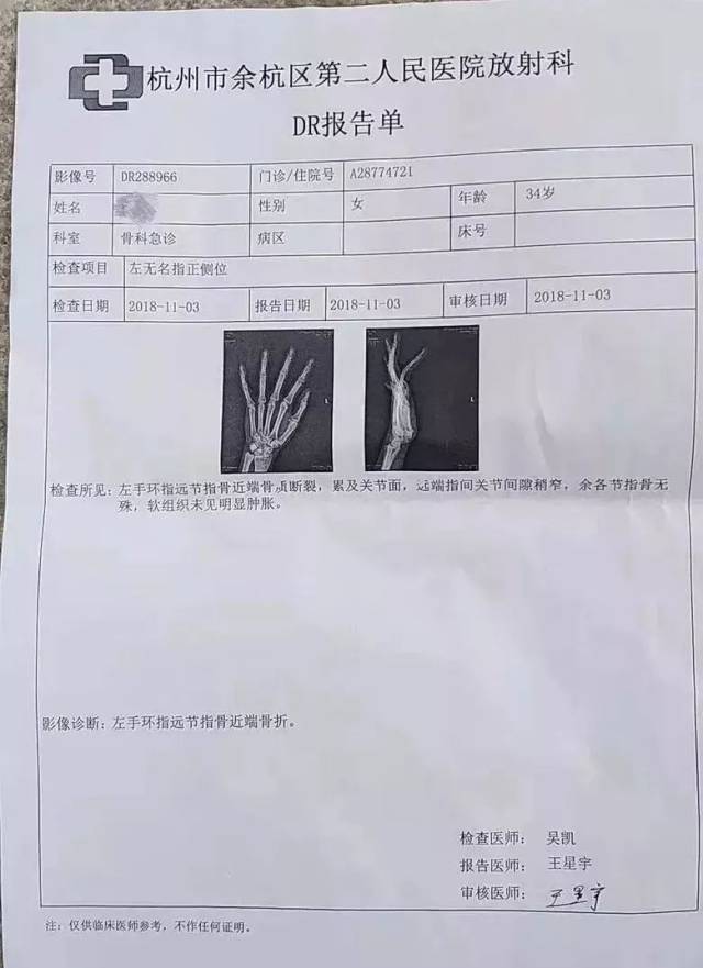 当天晚上,徐女士去医院拍了片子:她的无名指骨折了,全身多处挫伤.