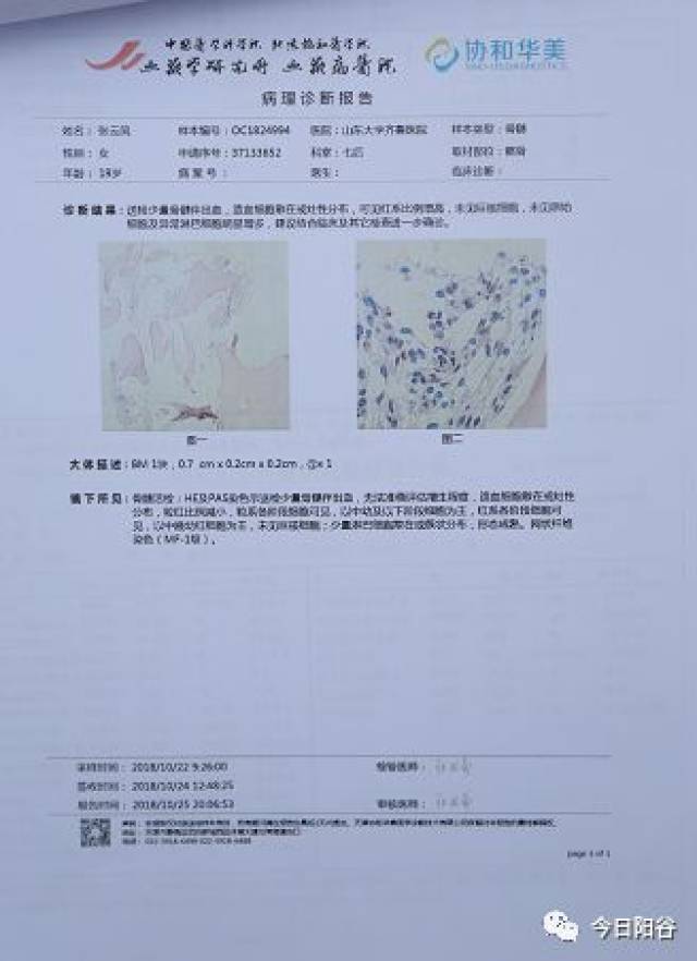 19岁的阳谷李台张云凤身患骨髓异常综合症急需您的爱心救助,恳请转发