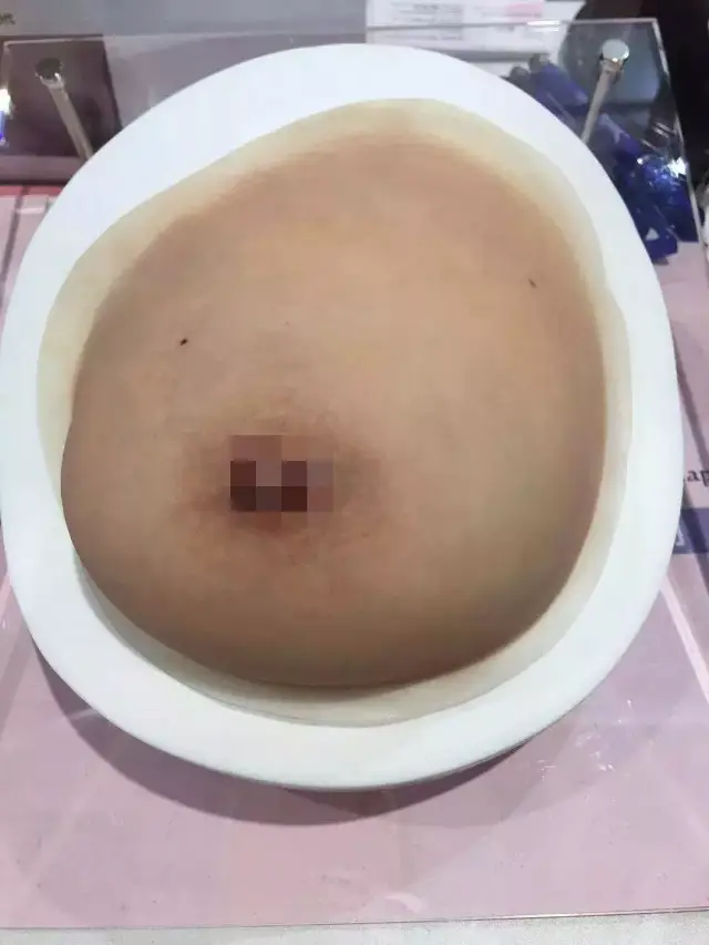 进博会现场,遇见雪伦定制的人工乳房