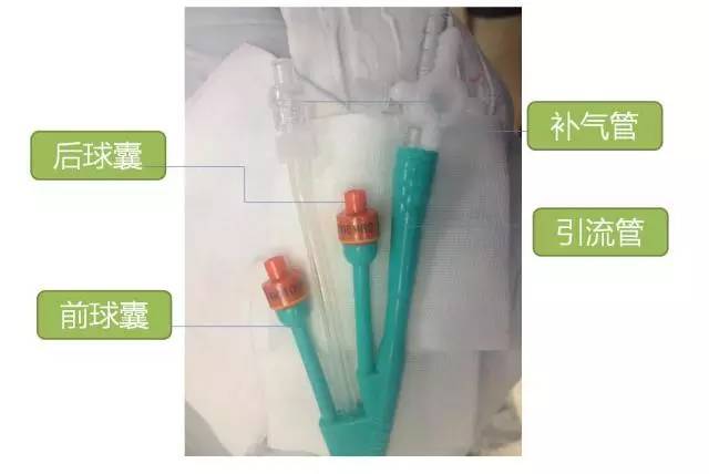 治疗肠梗阻新方法:专用肠梗阻导管置入