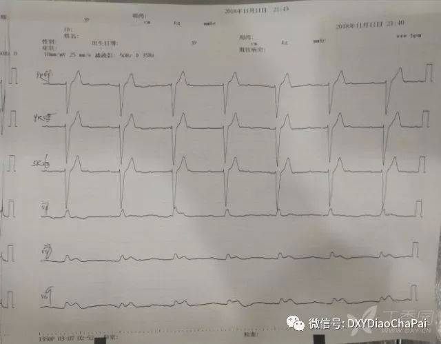 右室及后壁导联