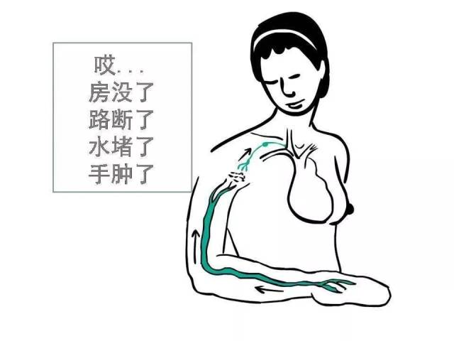 【一文读懂】乳腺癌术后上肢淋巴水肿的预防与治疗