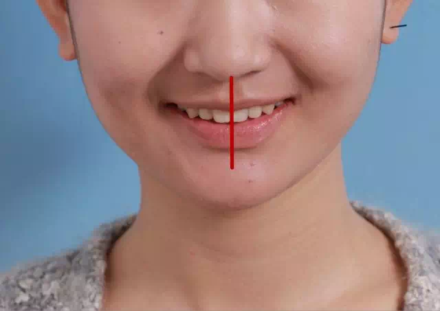 你邪魅狂狷的歪嘴笑该治治了