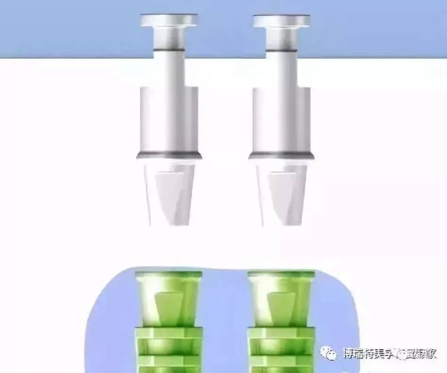 口腔种植印模及种植修复取模图解