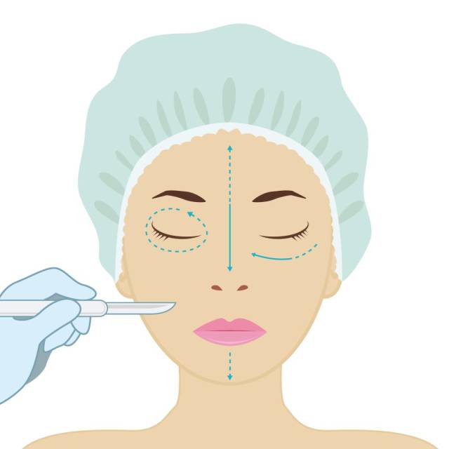 医美 | 这些错误的祛眼袋你还在犯?