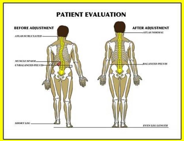 体态矫正之骨盆前倾