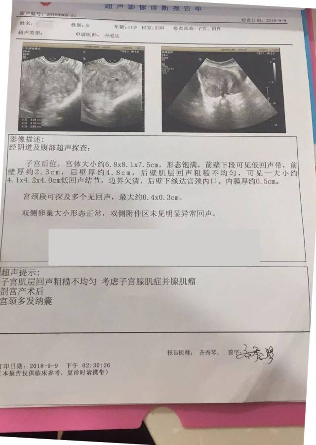 三次开腹手术史,加大了腺肌症保宫手术难度