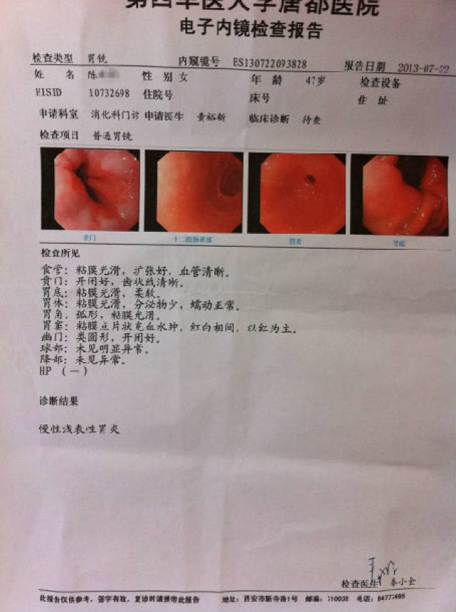 疗前胃镜报告 患者10:陈** 疗前胃镜为"胃窦部多发浅溃疡,慢性萎缩性