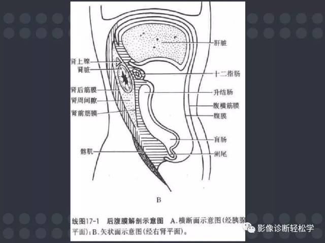 【每日一例| 718例】腹膜后肿瘤的诊断思路