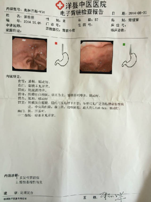 患者12: 赵** 疗前胃镜为"慢性萎缩性",疗后为"慢性伴糜烂"