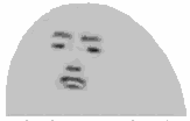 近视眼的人小心!你已经被这几种可致盲的