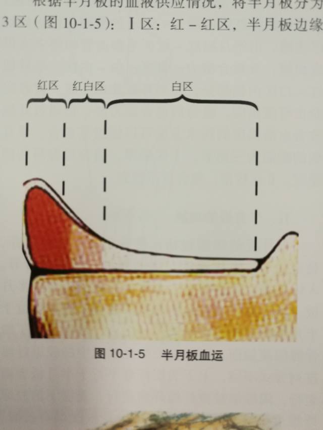 半月板损伤详解