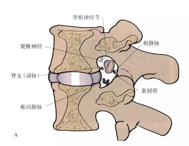 脊神经(腹侧根和背侧根并入神经根袖) ● 硬膜根袖,与椎间孔远端