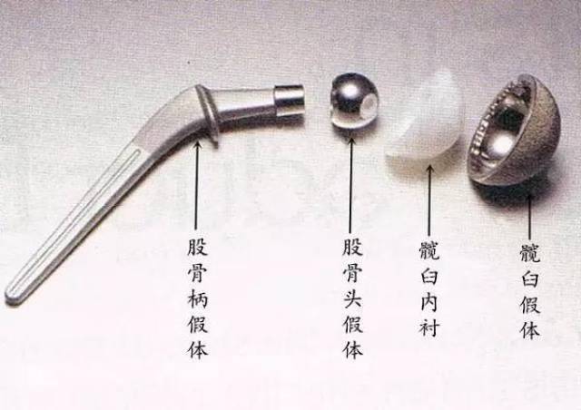 2.人工膝关节假体构造