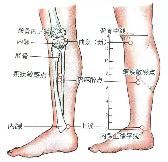 曲泉(新) 【定经取穴】位于小腿近端胫侧,股骨内上髁高点直下,髌骨中