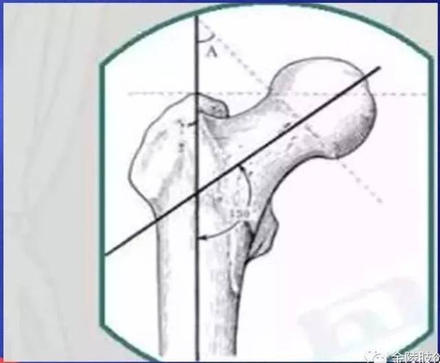 【强推】骨关节常用的角度测量方法汇总,一文搞定!_手机搜狐网