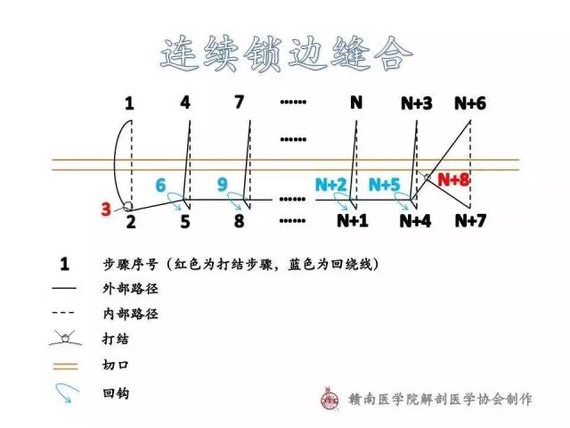 连续锁边缝合