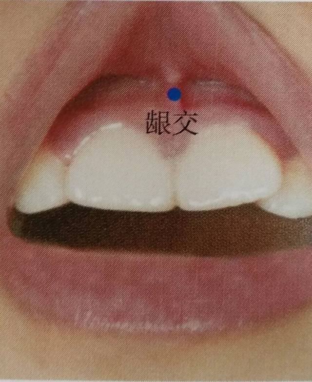 经前额下行鼻柱至鼻尖的 素髎穴,过人中,至上齿正中的 龈交穴.