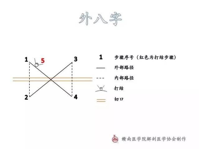 图解| 常用外科缝合路径示意图