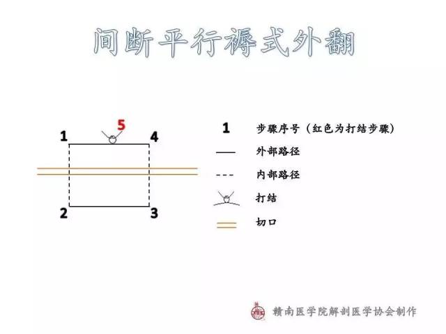 图解| 常用外科缝合路径示意图