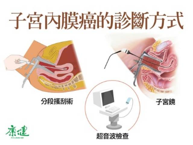 经期紊乱竟是子宫内膜癌的主要症状之一