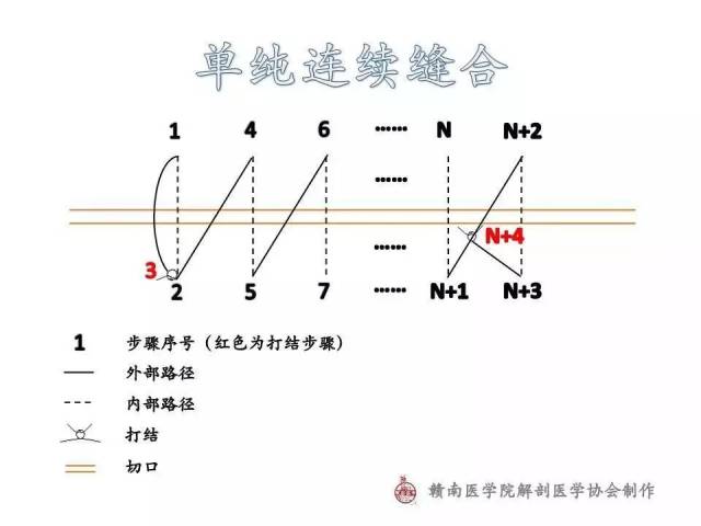 图解| 常用外科缝合路径示意图