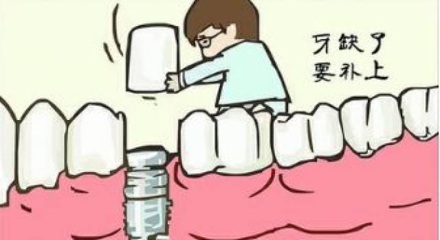 几张种植牙图片让你明白种植牙过程