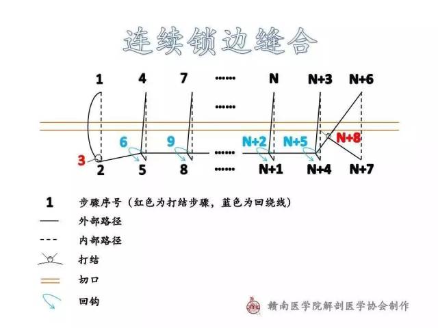 图解| 常用外科缝合路径示意图