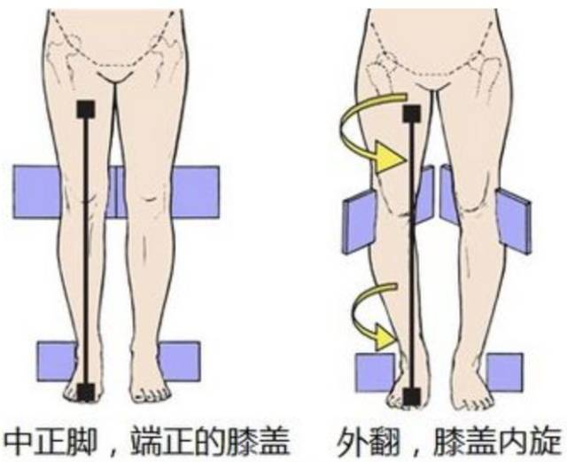 内八动作做久了会让股骨头内旋,往里弯,大腿根部则往外凸出,慢慢变成