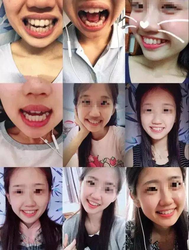 被骂"龅牙妹",那个23岁女孩做错了什么!