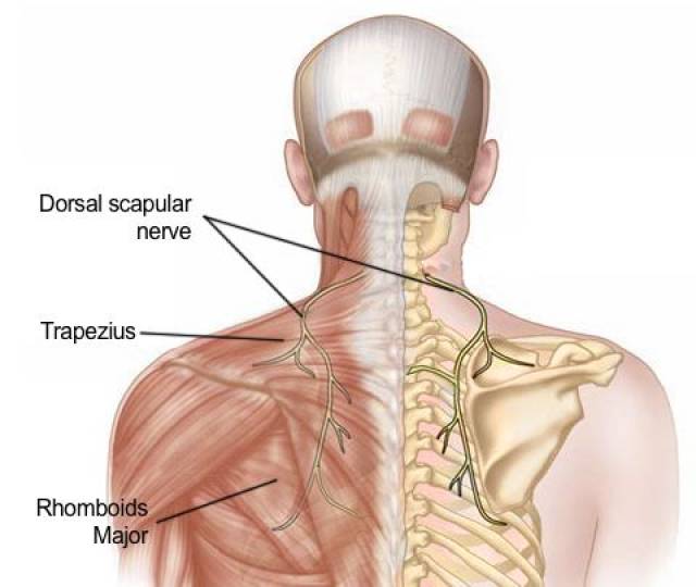 颈肩痛——肩胛背神经卡压