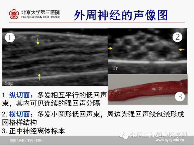 正中神经及腕管解剖