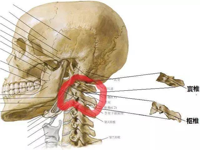 请儿童骨科主任王彤详细给大家说说吧 什么是寰枢关节半脱位?