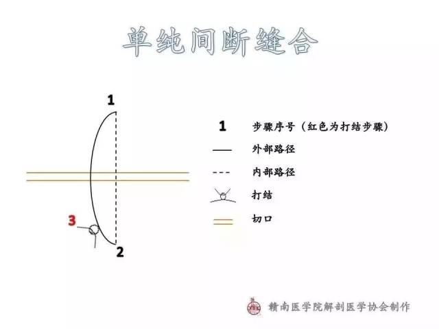 即针与创面切口平面垂直,可以轻提起切口 (2)针距1cm边距0