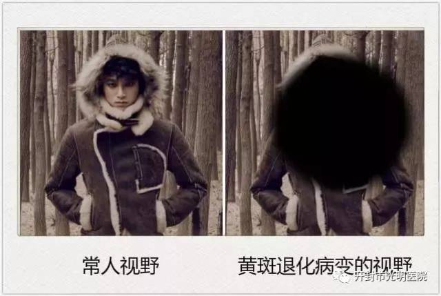 暗适应是指视网膜对暗处的适应能力:夜盲症,维生素a缺乏症,视网膜色素