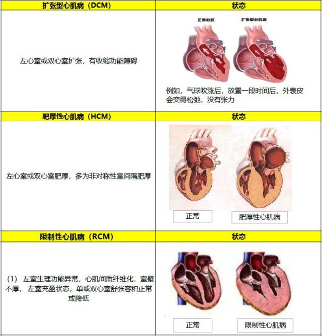 3,原发性心肌病的诊断